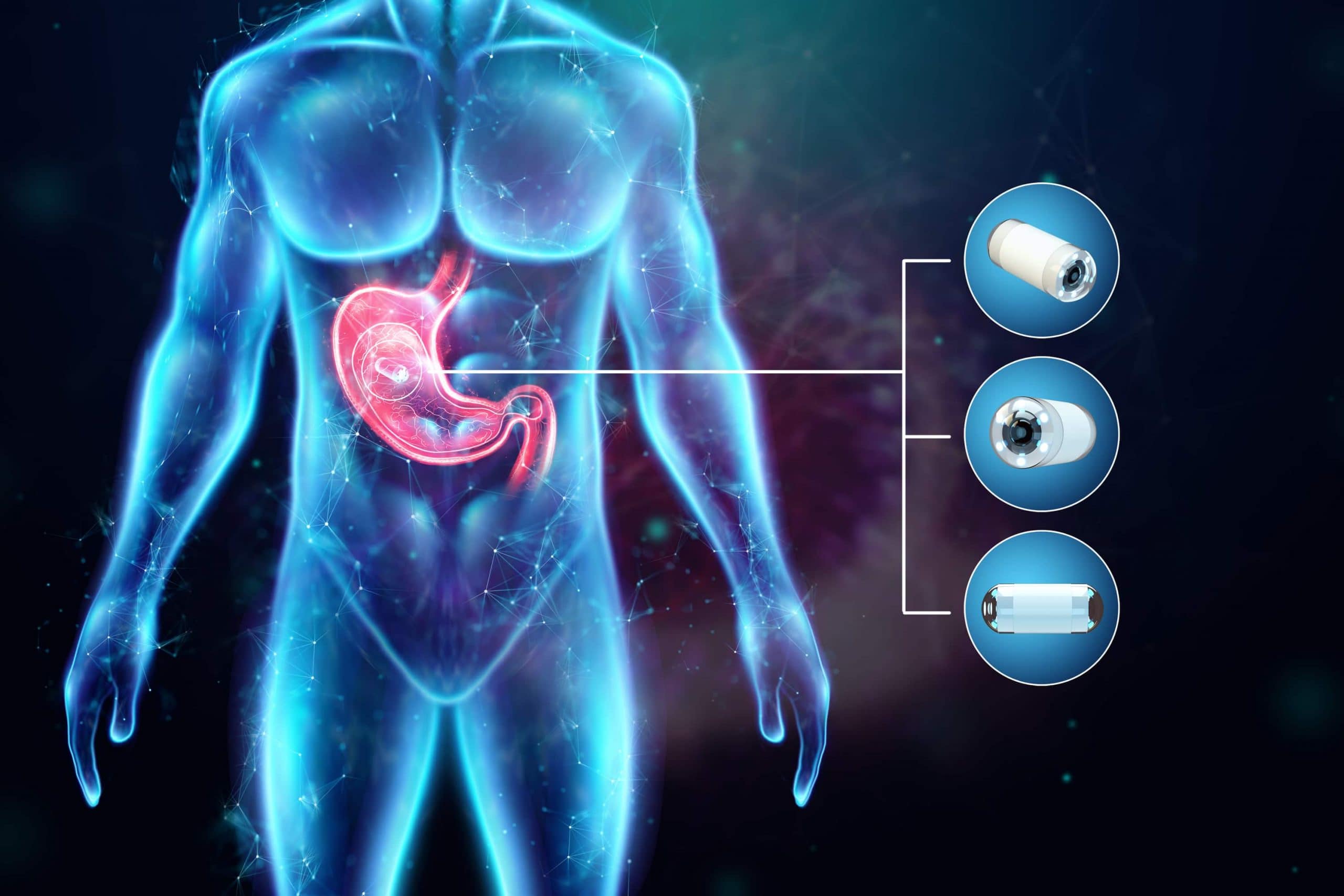 gastroenterology endoscopy
