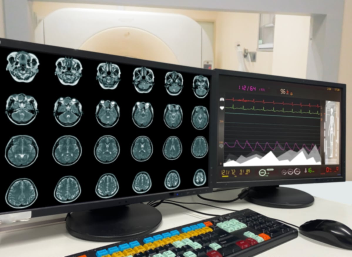 Traumatic Brain Injury Care on Staten Island, NY – Richmond University
