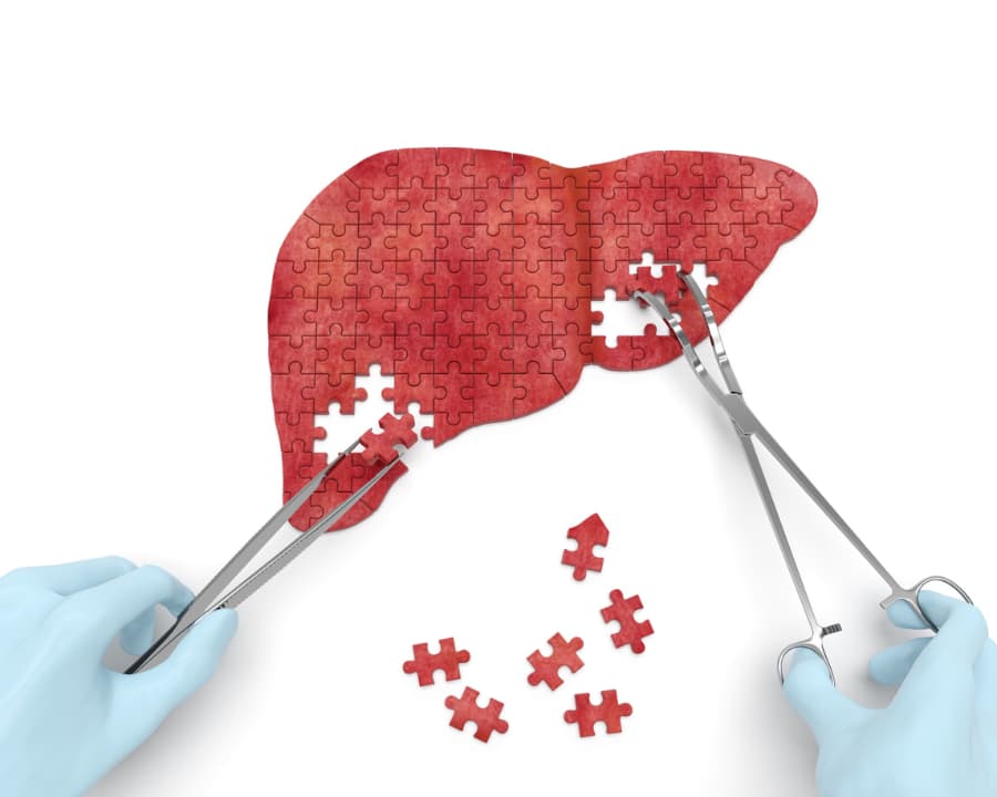 Liver operation puzzle concept art