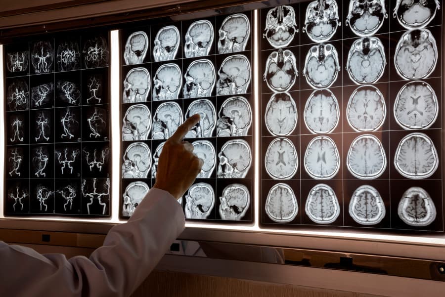 Neurosurgeon Analyzing Brain Scan
