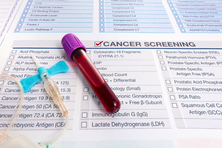 Blood test sample for cancer screening resting on chart