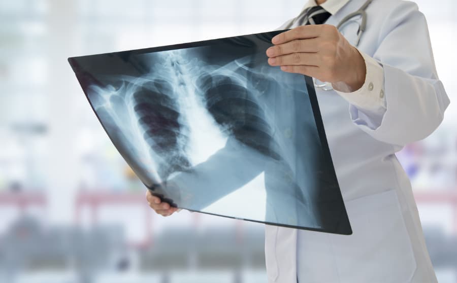 Physician examines X-ray of lungs